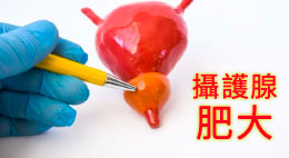 威而鋼(西地那非)治療攝護腺肥大，療效顯著@可靠